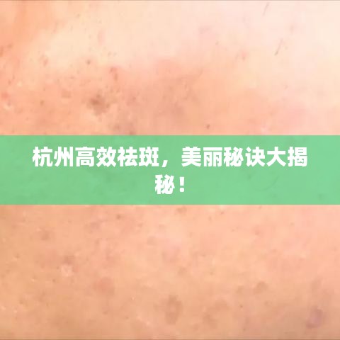 杭州高效祛斑，美麗秘訣大揭秘！