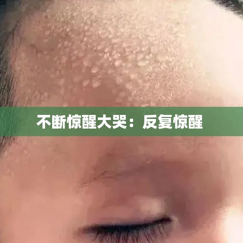 不斷驚醒大哭：反復驚醒 