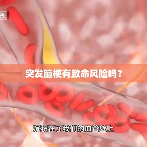 突發(fā)腦梗有致命風險嗎？
