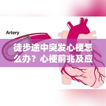 徒步途中突發(fā)心梗怎么辦？心梗前兆及應(yīng)對(duì)措施科普！