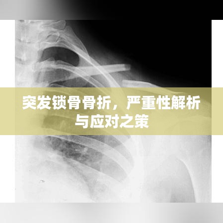 突發(fā)鎖骨骨折，嚴重性解析與應對之策