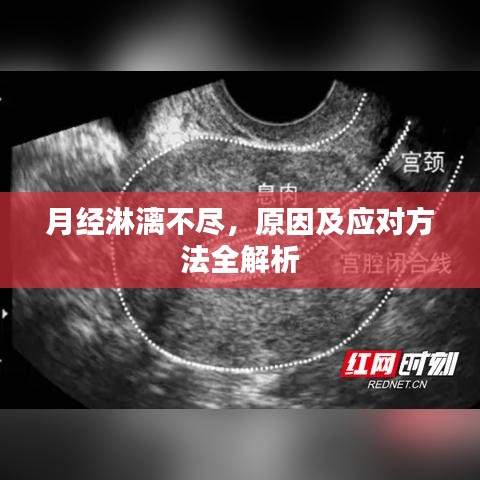 月經(jīng)淋漓不盡，原因及應(yīng)對方法全解析