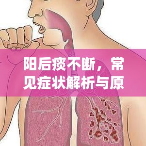 陽后痰不斷，常見癥狀解析與原因探究