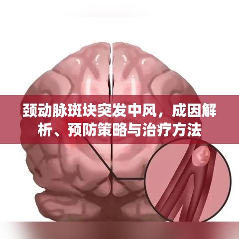頸動(dòng)脈斑塊突發(fā)中風(fēng)，成因解析、預(yù)防策略與治療方法